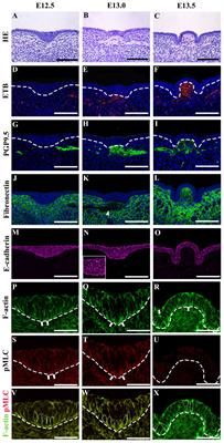 Action of Actomyosin Contraction With Shh Modulation Drive Epithelial Folding in the Circumvallate Papilla